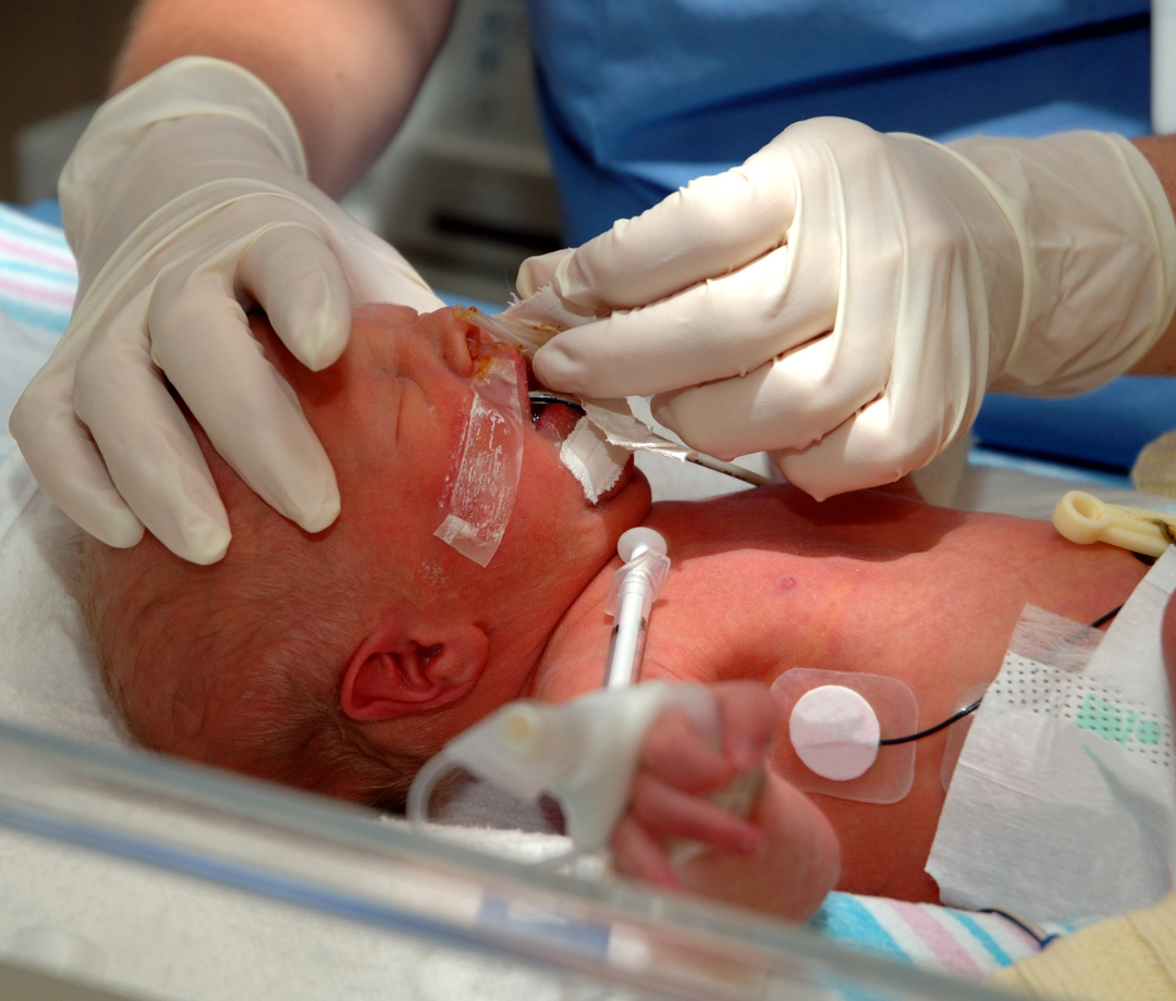 RECEPÇÃO E REANIMAÇÃO NEONATAL